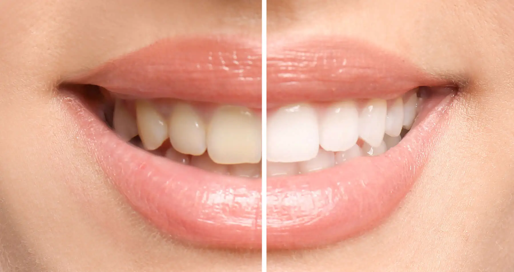 Gleem Dental Office Lakeview