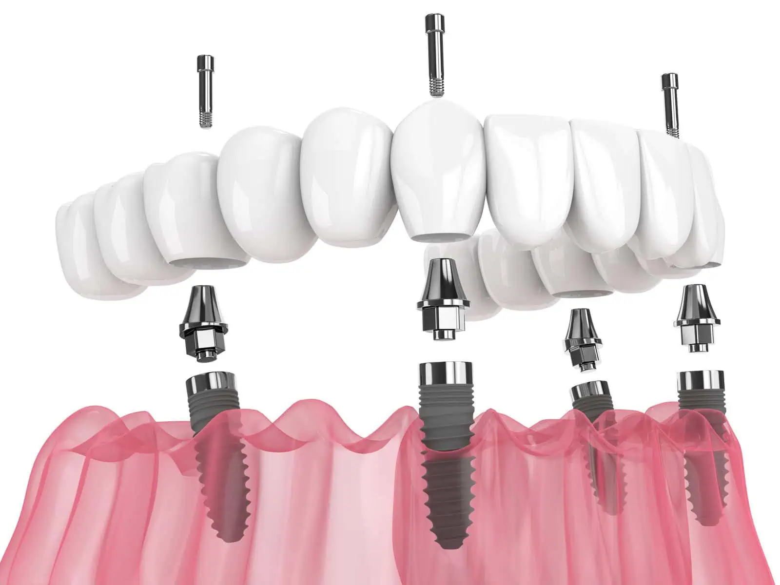 Gleem Dental Office Lakeview